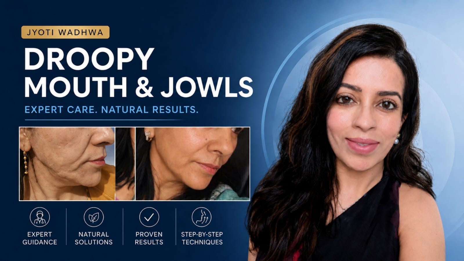 Droopy Mouth and Jowls Challenge