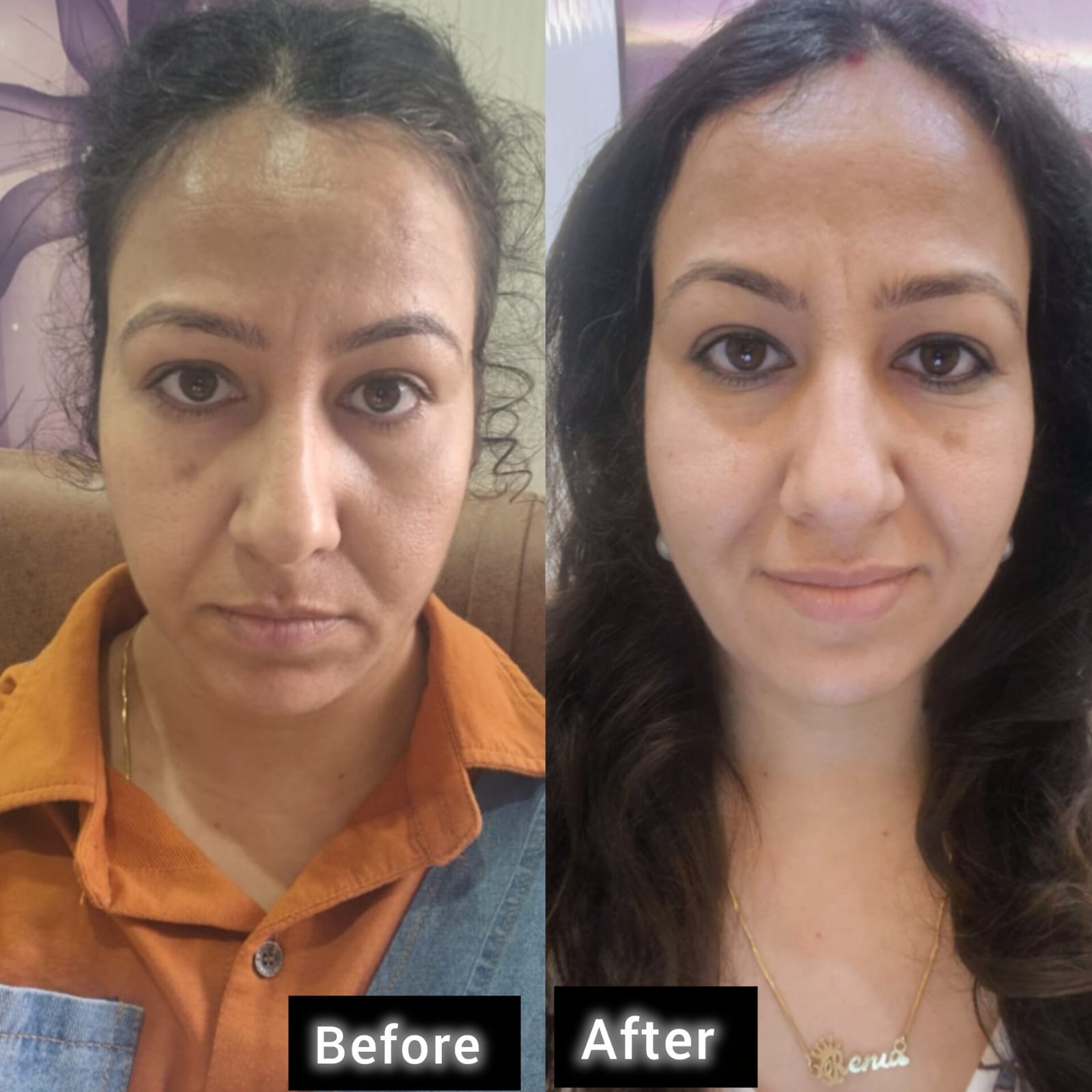Testimonial from Mrs. Renu