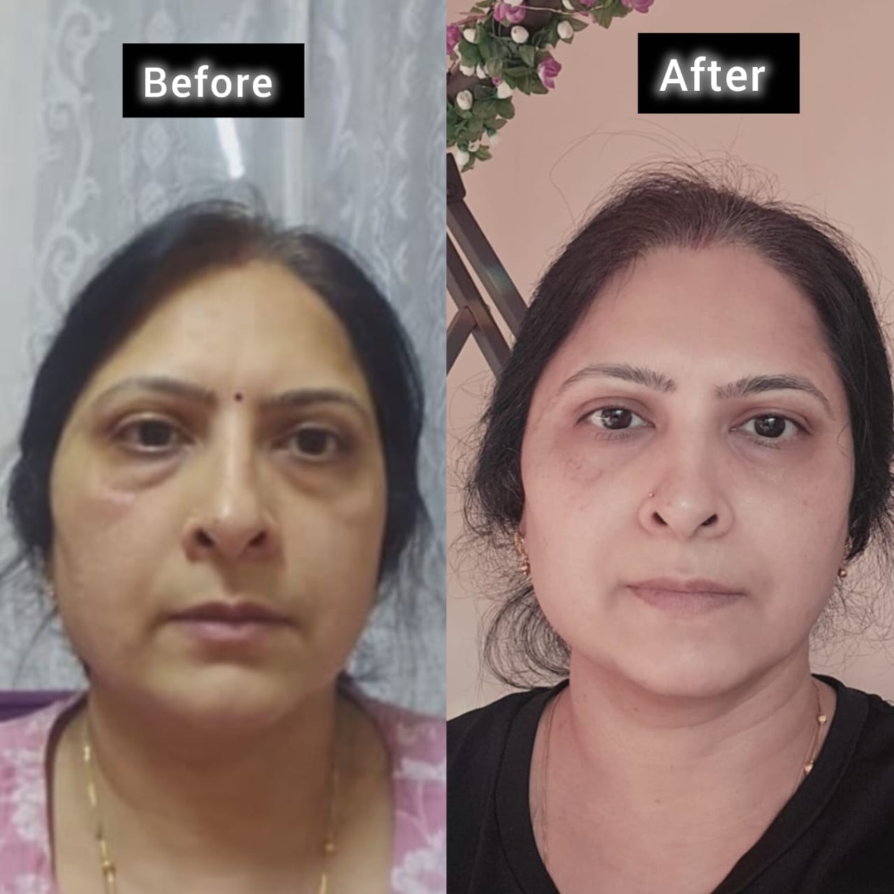 Vandana